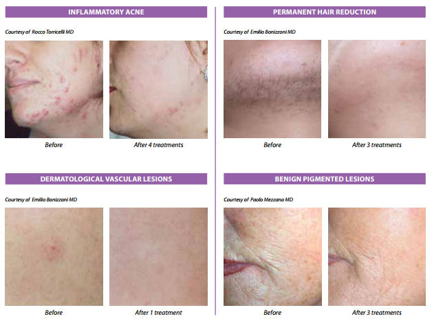 536f383d1ed2d9e13c07e733_beforeafter.jpg